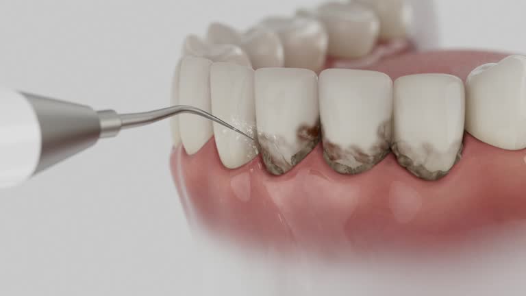 Trusted Tooth Extraction service in Port Norris, NJ - Dentist Open Now